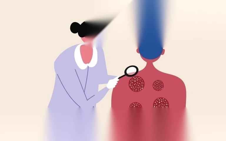 kham da lieu co duoc huong bao hiem y te khong image 01