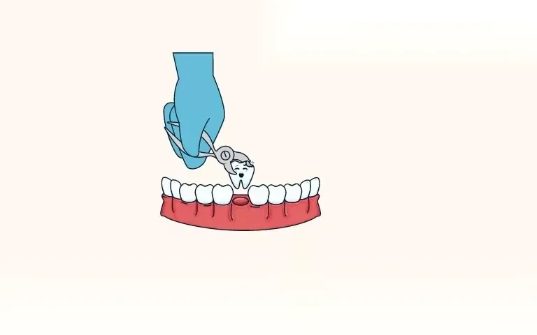 nho rang co duoc bao hiem y te khong image 01